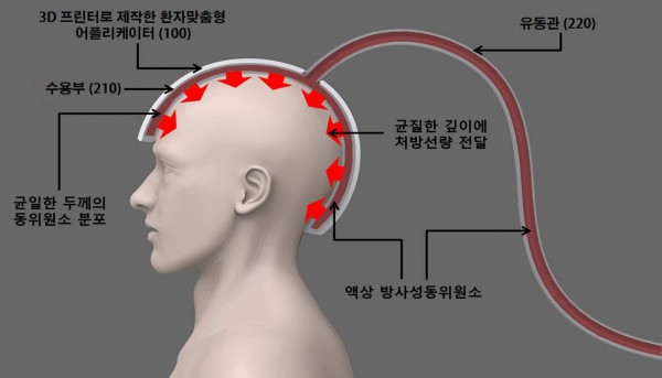 액상 방사성 동위원소를 이용한 원격 후장착 방사선 근접 치료 장치