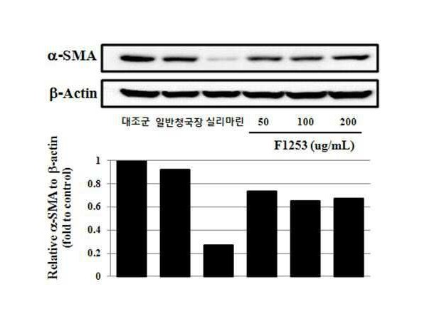 바실러스 아리아바타이(Bacillus aryabhattai)에 의한 콩 발효물을 유효성분으로 포함하는 간 질환 예방, 개선 또는 치료용 조성물