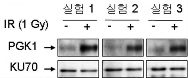 방사선 피폭 진단용 마커 포스포글리세레이트 키나제, 그 마커의 발현수준을 측정하는 방사선 피폭 진단용 조성물, 그 조성물을 포함하는 방사선 피폭 진단용 키트, 및 그 마커를 이용한 방사선 피폭을 진단하는 방법