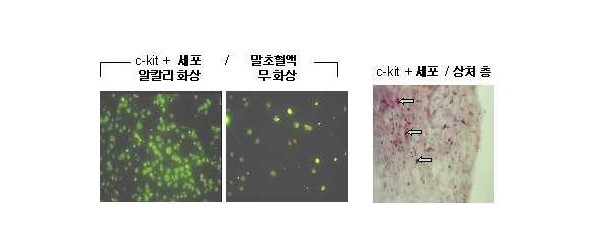 중배엽 줄기세포 및/또는 Ｐ 물질을 함유하는 상처 치유또는 상처 치유 촉진제, 또는 세포 치료제